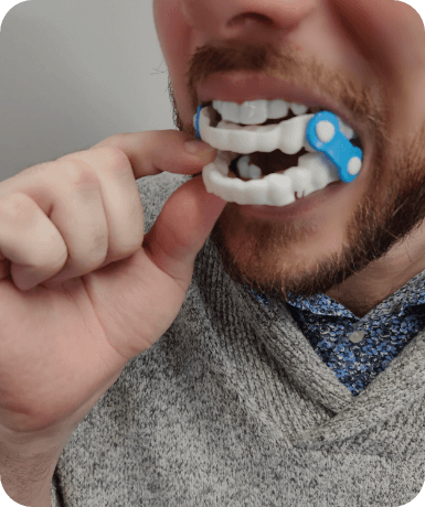 A man wearing a dental item with blue locks
