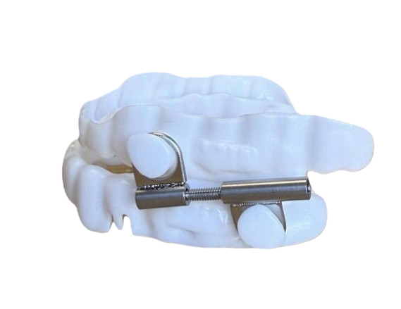 Dental Appliance